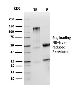 Recombinant Lambda Light Chain (B-Cell Marker) Antibody