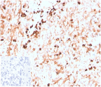 Recombinant Lambda Light Chain (B-Cell Marker) Antibody