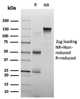 ZHX3 (Transcriptional Repressor) Antibody