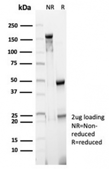 CD23 (Fc Epsilon RII) Antibody