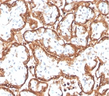 Recombinant HCG-beta (Pregnancy & Choriocarcinoma Marker) Antibody