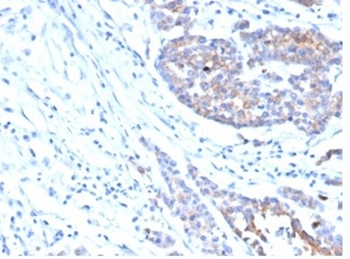 IGF1R / CD221 Antibody