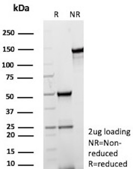 MerTK (Innate Immune Checkpoint) Antibody