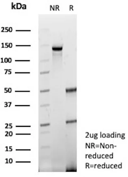 Dystrophin (DMD) (Marker of Duchenne and Becker Muscular Dystrophy) Antibody