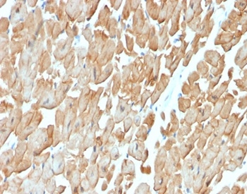Dystrophin (DMD) (Marker of Duchenne and Becker Muscular Dystrophy) Antibody