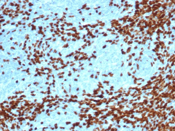 Recombinant TdT / DNA Nucleotidylexotransferase (Acute Lymphoblastic Leukemia Marker) Antibody