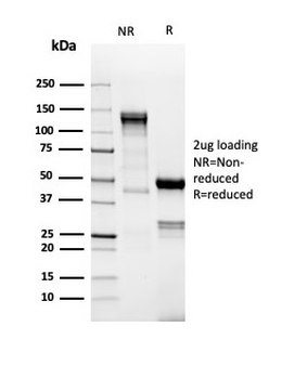 Recombinant TdT / DNA Nucleotidylexotransferase (Acute Lymphoblastic Leukemia Marker) Antibody