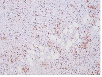 Recombinant ALK (Anaplastic Lymphoma Kinase) / CD246 Antibody