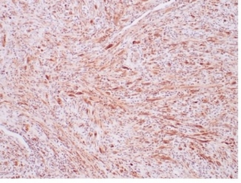 Recombinant ALK (Anaplastic Lymphoma Kinase) / CD246 Antibody