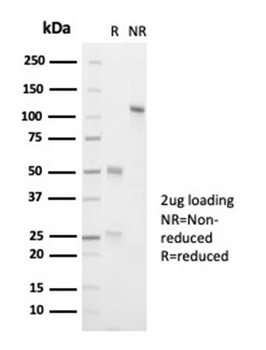 Recombinant ALK (Anaplastic Lymphoma Kinase) / CD246 Antibody