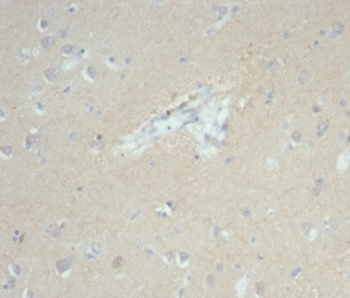 EPCAM Antibody