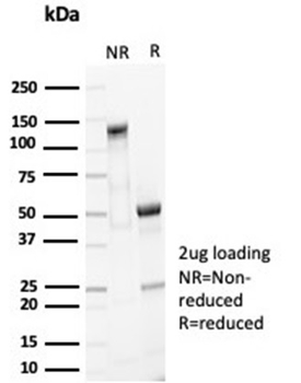 EPCAM Antibody