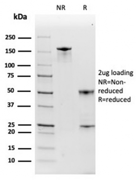 HP Antibody