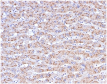CD40 Ligand / CD154 / TRAP1 (Activation Marker of T-Lymphocytes) Antibody