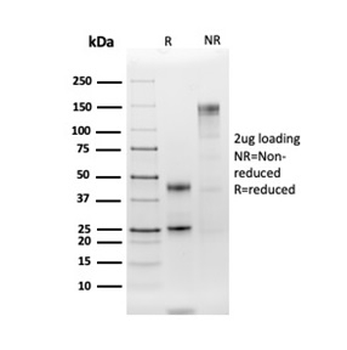 HLA-DR (MHC II) Antibody