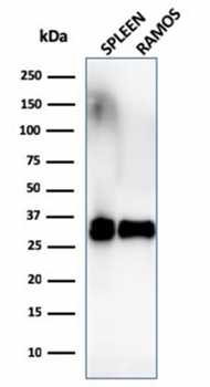 HLA-DR (MHC II) Antibody