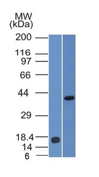 PAX2 (Renal Cell & Ovarian Carcinoma Marker) Antibody