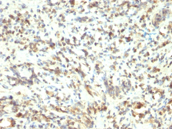 MyoD1 (Rhabdomyosarcoma Marker) Antibody