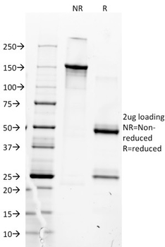 MyoD1 (Rhabdomyosarcoma Marker) Antibody
