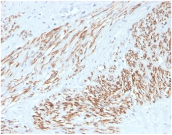 Recombinant Smooth MuscleMyosin Heavy Chain (SM-MHC) (Leiomyosarcoma & Myoepithelial Cell Marker) Antibody