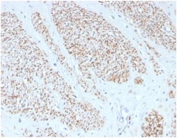 Recombinant Smooth MuscleMyosin Heavy Chain (SM-MHC) (Leiomyosarcoma & Myoepithelial Cell Marker) Antibody
