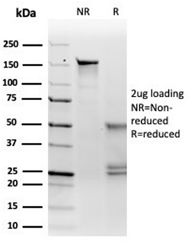Microphthalmia Transcription Factor (MITF) Antibody