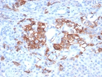 CD99 / MIC2 (Ewing s Sarcoma Marker) Antibody