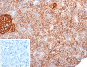 CD99 / MIC2 (Ewing s Sarcoma Marker) Antibody
