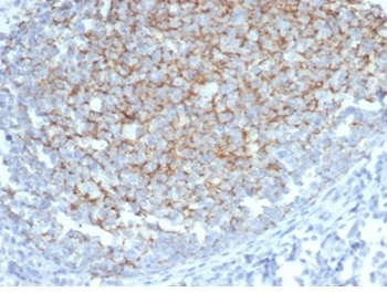Interferon alpha Antibody