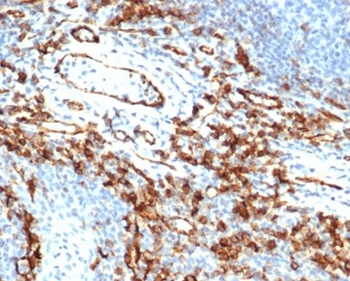 Recombinant CD31 / PECAM-1 (Endothelial Cell Marker) Antibody