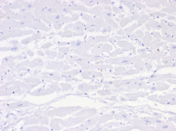 Negative Control for Mouse Monoclonal Antibodies Antibody