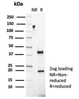 Negative Control for Mouse Monoclonal Antibodies Antibody