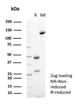 ABO Antibody