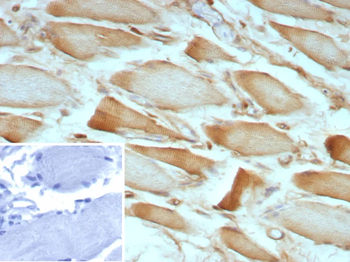 ZNF804A Antibody