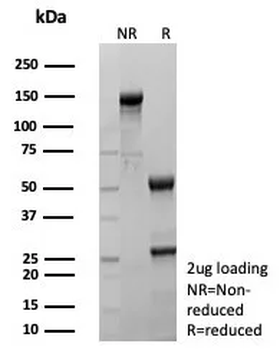 Recombinant TAG-72 / CA72.4 (Tumor-Associated Glycoprotein) Antibody