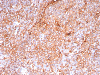 Recombinant Pan-HLA-II (DP, DQ, DR) Antibody