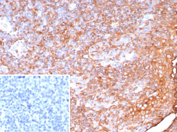 Recombinant Pan-HLA-II (DP, DQ, DR) Antibody