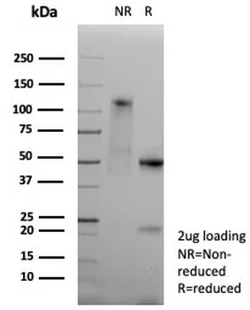 Recombinant Pan-HLA-II (DP, DQ, DR) Antibody