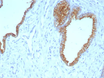 Cytokeratin 5/6 (Basal, Myoepithelial & Mesothelial Cell Marker) Antibody