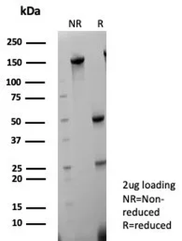 Cytokeratin 5/6 (Basal, Myoepithelial & Mesothelial Cell Marker) Antibody