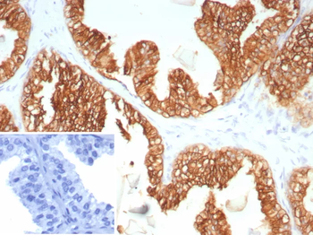 KRT5 Antibody