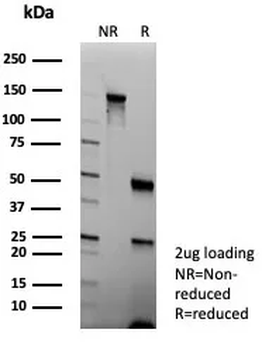 KRT5 Antibody