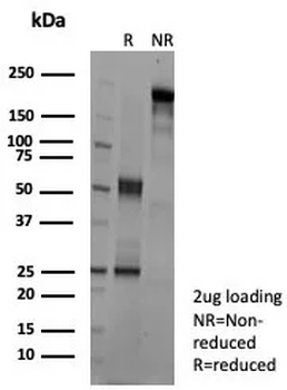 KLK4 Antibody