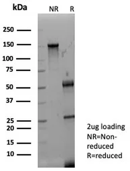 FGF23 Antibody
