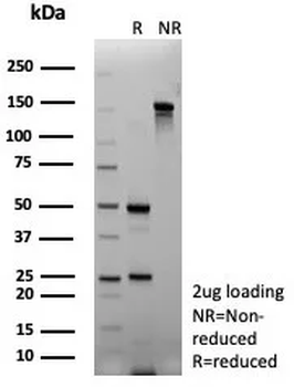 FGF23 Antibody