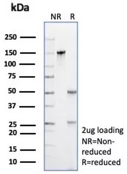 PRAME nuclear receptor transcriptional regulator Antibody