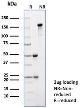 PRAME nuclear receptor transcriptional regulator Antibody