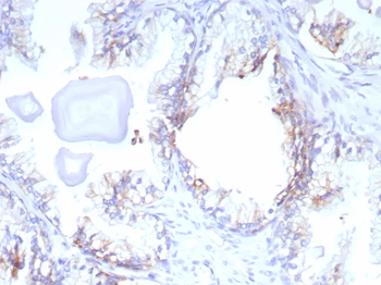 ABCC4 Antibody