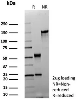 ABCC4 Antibody