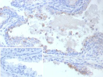 ABCC4 Antibody